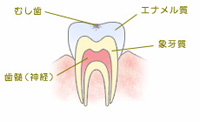 C0：脱灰